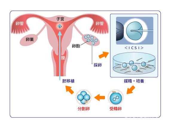 【2026最新】河南供卵来源渠道对比：公立排队与私立机构等待时间全解析